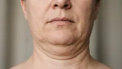 5 esercizi che aiutano a eliminare il doppio mento